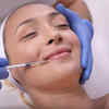 Jawline Fillers: What Are They?