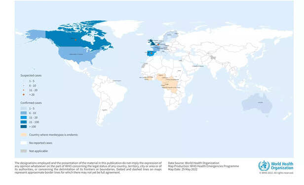 359923-20220531monkeypoxmulticountryrevisedcropped-scaled-1
