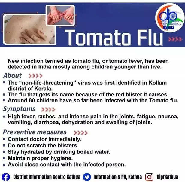 361230-whatsapp-image-2022-08-29-at-52415-pm