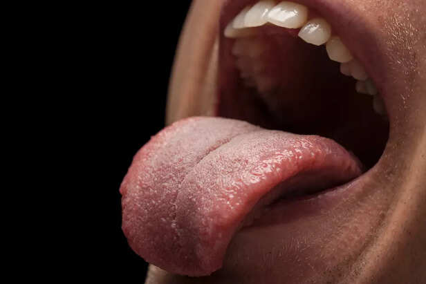 Healthy Tongue