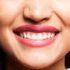 A Perfect Smile - Trendy Whitening Kit