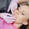 Dentist Supervised Whitening