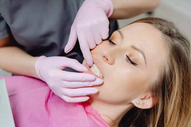 Dentist Supervised Whitening