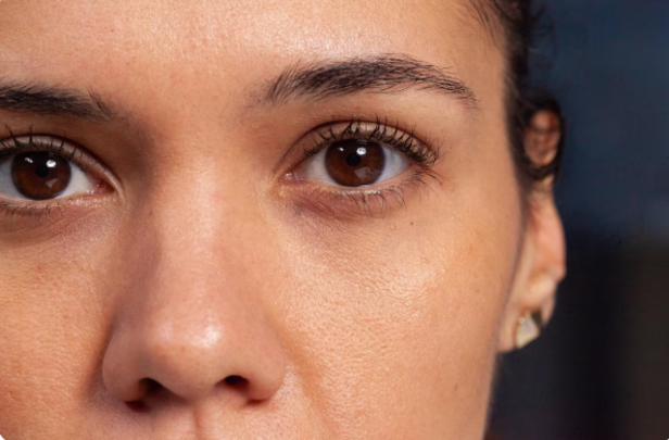 Skin Around The Eyes
