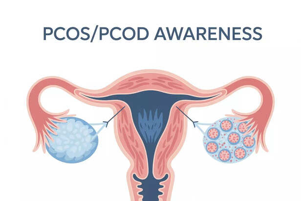 PCOS/PCOD Awareness