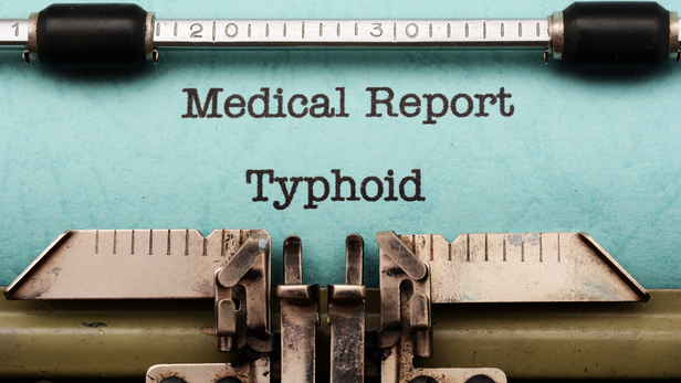 Lancet South Asia में प्रकाशित 2023 की एक स्टडी ने भारत में टाइफाइड के बोझ की गंभीर तस्वीर सामने रखी है।