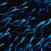 Alarming Drop In Sperm Count Across The World Find Researchers In ...