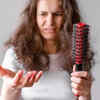 Hairfall