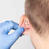 Evidence Of First-Ever Ear Surgery From 5,300 Years Ago Found In Spain