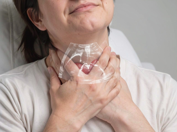 Thyroid  Symptoms In Women