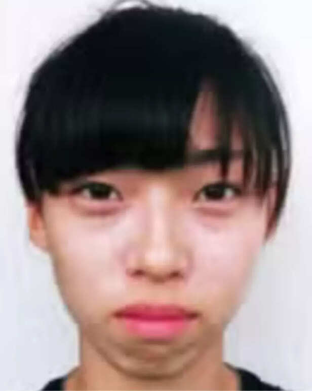 Plastic surgery rumors surrounding Kim Min-gee spark after before and after photos. Credit: X