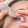 Eye Injuries