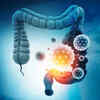 Gut health plays a key role in prevention