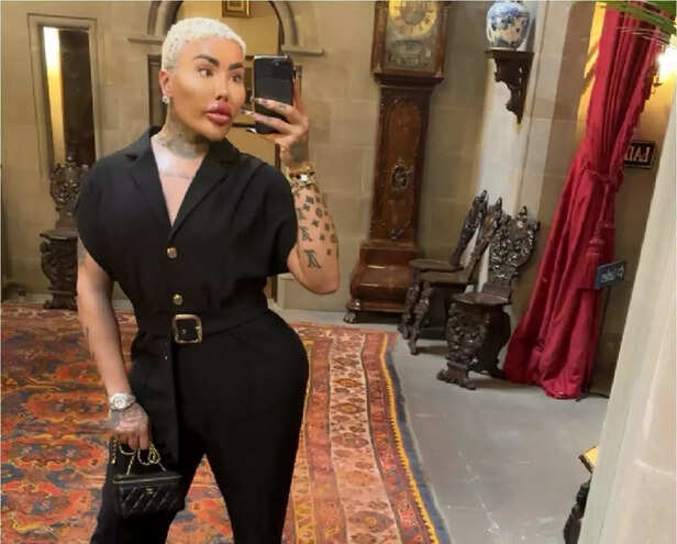 Britain’s ‘Lip King’ Jordan James Parke dies at 36:  Did cosmetic obsession play a role in his untimely death? Here’s what we know