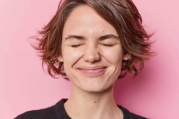 Smile Lines