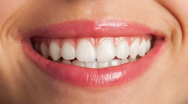 Whiten Teeth