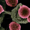 Annual Cancer Deaths In India Increased By More Than 35,000 Between ...
