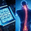 This New 'Intelligent Spine' Tech Tries Using AI To Restore Movement In ...