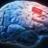 Solution For Failing Memory? Surgically Implanted Brain Chips Coming ...