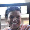 This Acid Attack Survivor's Story Is A Lesson To All Of Us To Keep ...