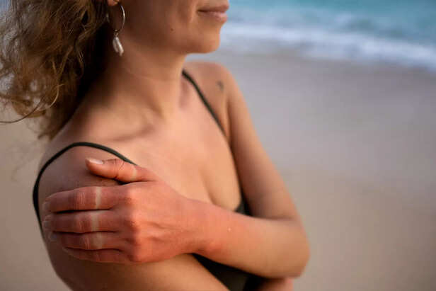 Sun Damage Skin Close-Up