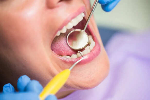How to Prevent Cavity                (Image Credit:Freepik)