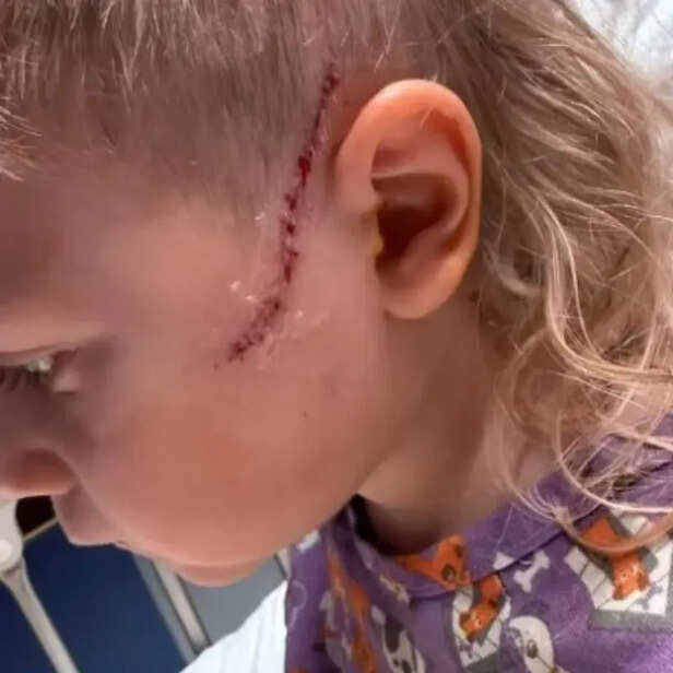 X/@joshryanjames | The injured child was transported to a children's hospital.