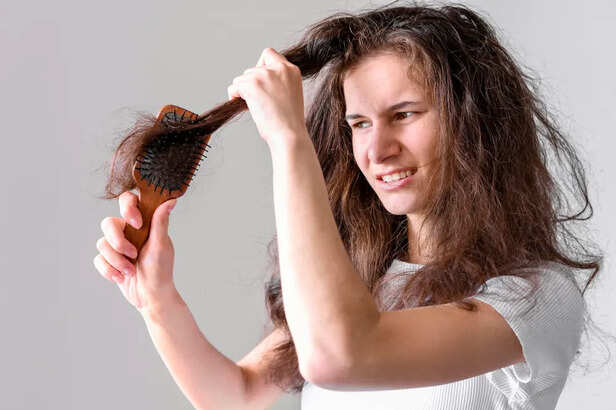 Visible Hair Fall                                         (Image Credit:Freepik)