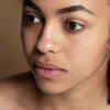 Dry and Dull skin                   (Image Credit:Freepik)
