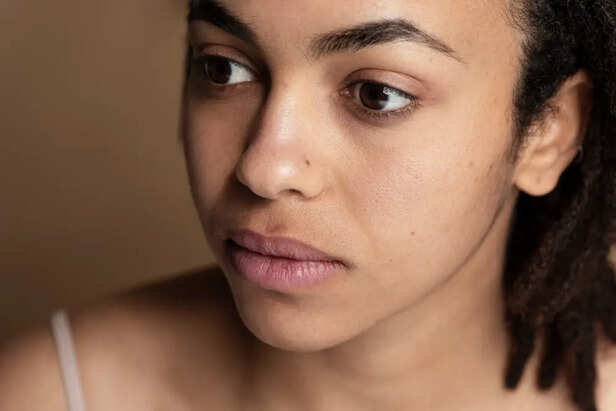 Dry and Dull skin                   (Image Credit:Freepik)