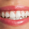 Healthy teeth                           (Image Credit:Freepik)