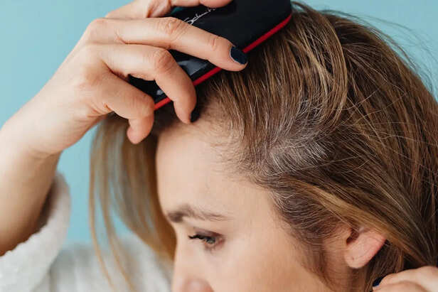 Healthy Clean Scalp