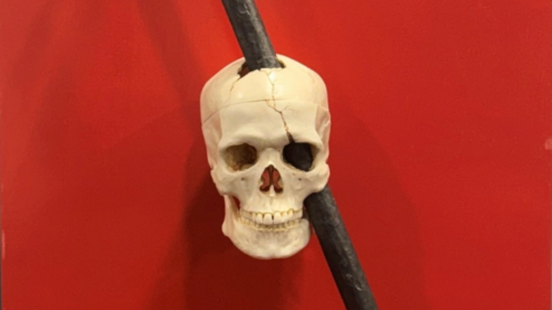 Phineas Gage's Skull With Rod at UNSW Museum of Human Disease | Instagram - @UNSW Museum of Human Disease