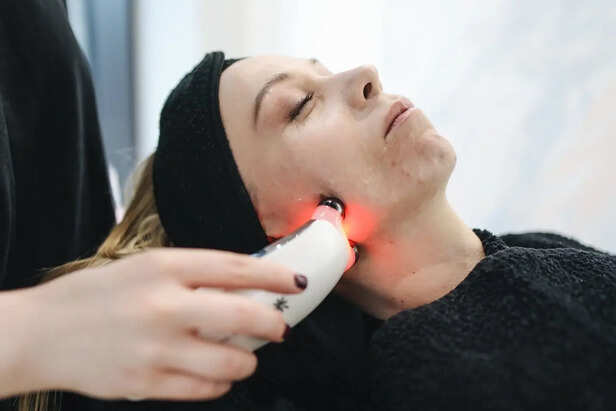 Laser Toning Procedure for Clear Skin