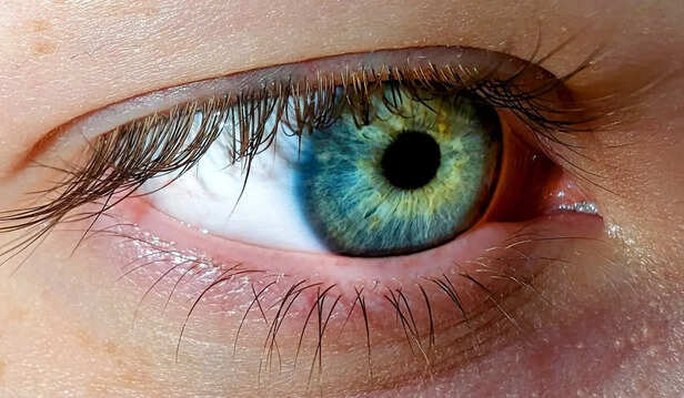 Eye Problems