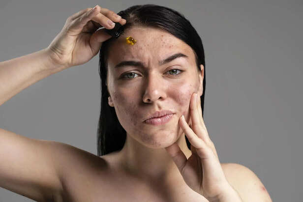 7 Signs Your Skin Barrier May Need Attention