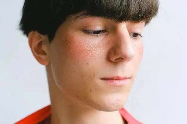 Understanding Unexplained Facial Redness