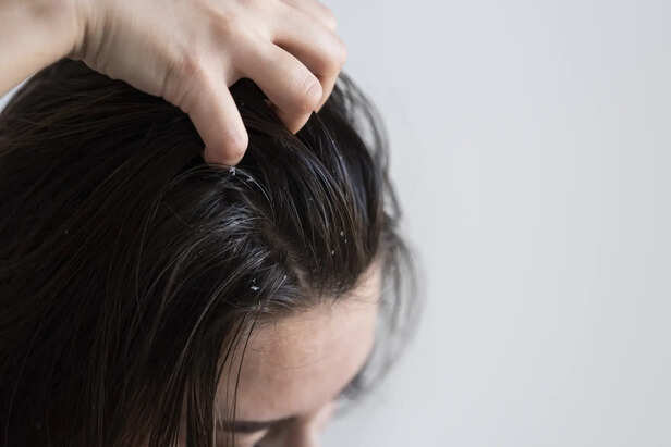 Natural Scalp Oil Production