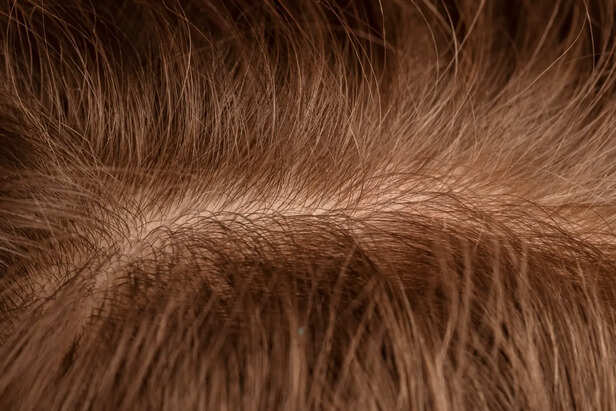 Close-Up of Healthy Scalp and Hair Roots