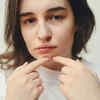 Picking Pimples Can Lead to Acne Scars