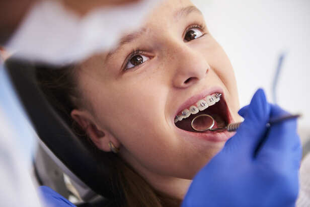 Dental checkup