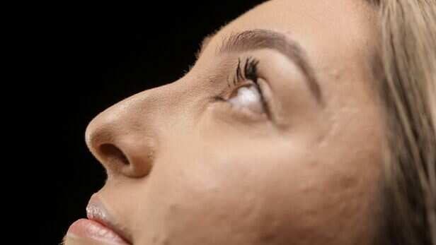 Nose shape