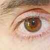 Dry eyes