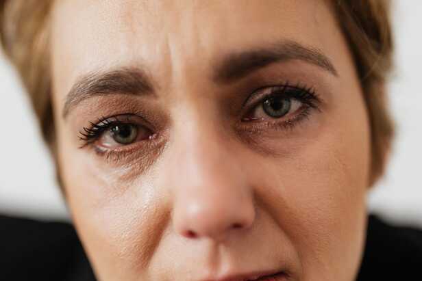 When Stress Takes a Toll on Your Skin
