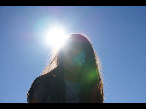 Protecting The Scalp From Sun Exposure