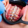 Healthy Gums And Oral Hygiene