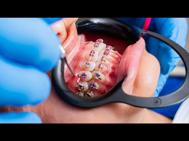 Healthy Gums And Oral Hygiene