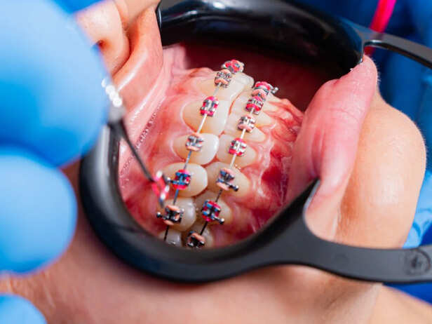 Healthy Gums And Oral Hygiene