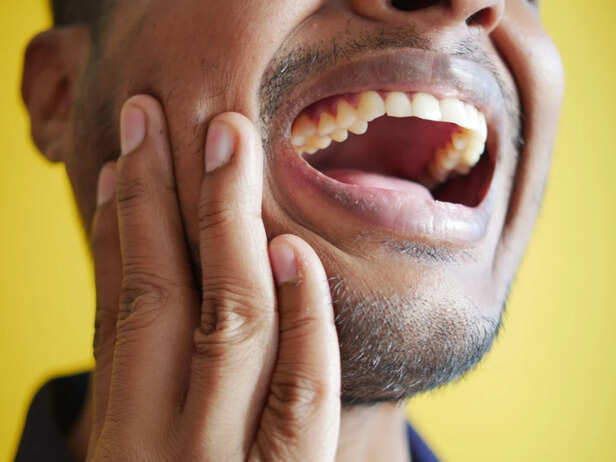 Healthy Gums During the Monsoon
