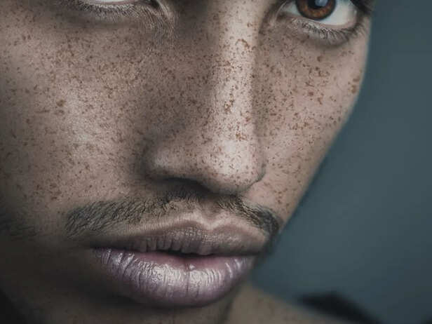 Dry Lips and Dehydrated Skin